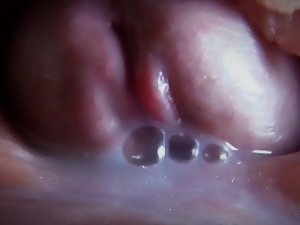 ナチュラル授精