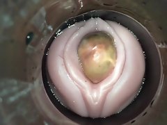 سہ پر کیمرے آدمی کی طرف سے چپچپا ovulation کے