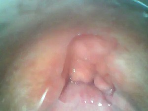 Membrane Arrondissement back my Obese Pigs cunt. Inner PINK